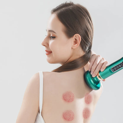 Electric Vacuum Cupping Massage